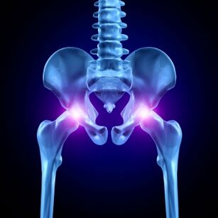 Hip joint pain can be acute, painful or chronic