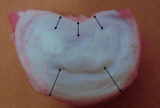 what does the intervertebral disc look like