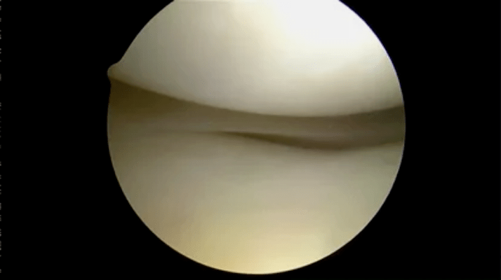 an astroscopic view of completely healthy surfaces