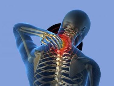 People with osteochondrosis of the cervical spine suffer from neck pain
